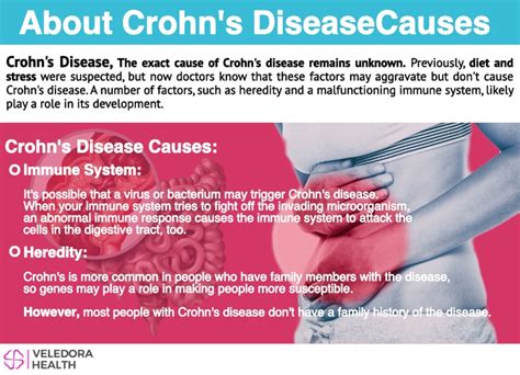 Crohns Disease Early Signs Causes Treatment And Diet