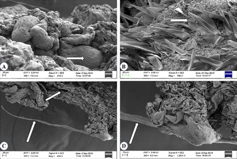 Field Emission Scanning Electron Micrograph Carl Zeiss Model Gemini