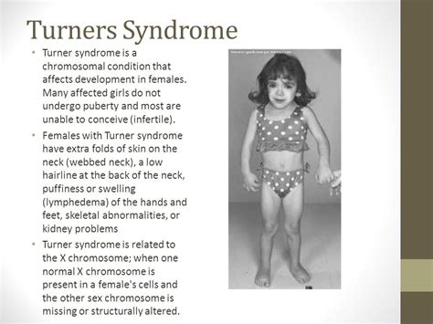 Genetic Diseases Ppt Video Online Download