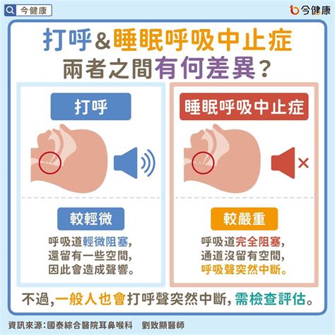 打呼聲突然不見了？醫教4招觀察睡眠呼吸中止症，防死亡風險｜呼吸胸腔｜醫療｜元氣網