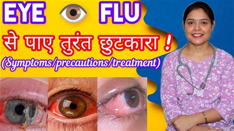 Eye Flu Symptoms Precautions And Treatment Eye Flu Conjunctivitis