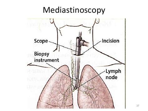 Thoracic Cavity And Mediastinum