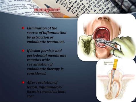 Osteomyelitis Of Jaw Department Of Oral Medicine And Radiology