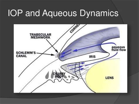 Angle Closure Glaucoma