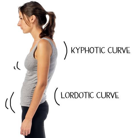 Lordosis Treatment Before After