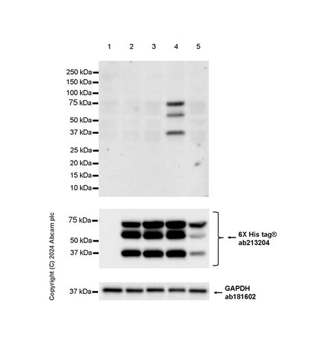 Anti Estrogen Receptor Alpha Mutated Y537s D538g 抗体 Epr28709 35