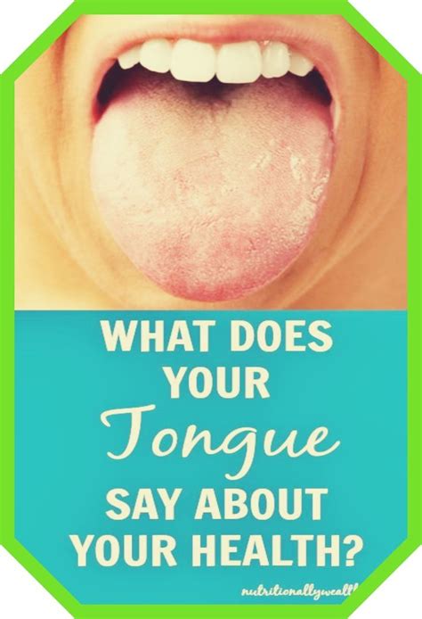 What Does Your Tongue Say About Your Health Artofit