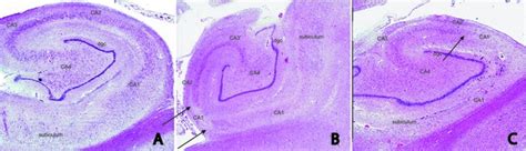 (A) Low-power image of an H&E-stained section of an intact hippocampus ... 