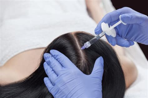 Mesotherapy For Hair Loss Six Sessions Parkland Natural Health