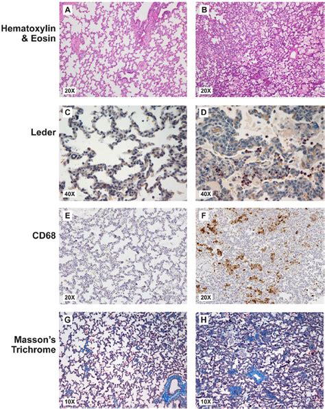 Histopathology Of The Fetal Lungs Are Shown On The Left For A Saline Download Scientific