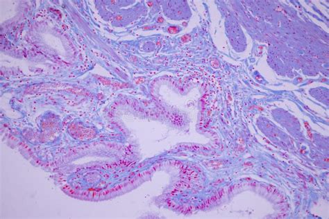 Columnar Epithelium Of Human Gall Bladder Under The Microscope In Lab