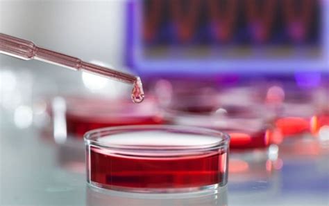 Серповидноклеточная анемия: причины и проявления | MedAboutMe