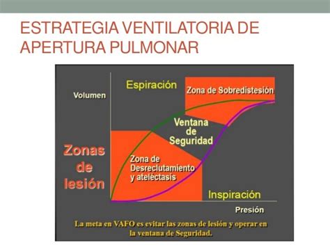 Ventilacion De Alta Frecuencia Uci Nov