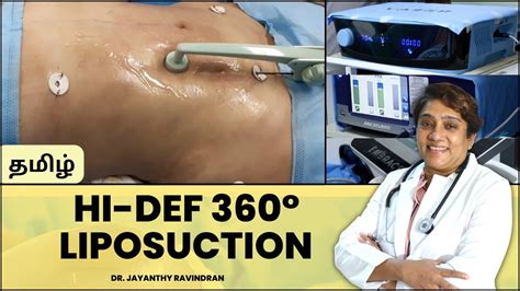 360° Liposuction Hi Def 3 In 1 Liposuction Liposuction Treatment In Chennai Tamiralife