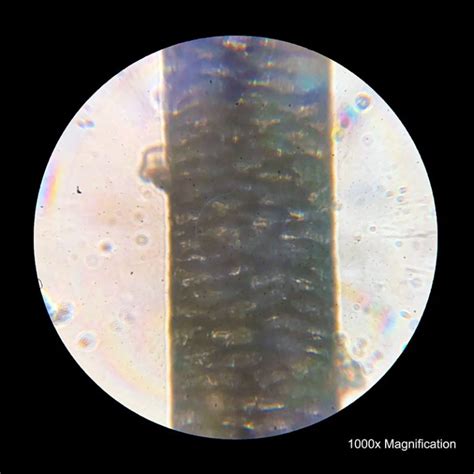 hair  microscope structure analysis  health insight