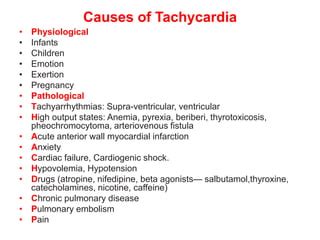 TACHYCARDIA IN ECG ,CAUSES AND MANAGEMENT OF TACHYARRHYTHMIAS | PPT