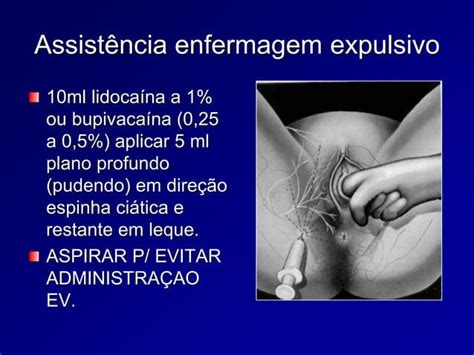 Asistencia De Enfermagem Aos Periodos Do Parto Ppt