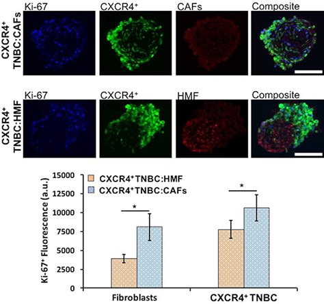 Three Dimensional Tumor Model Mimics Stromal Breast Cancer Cells