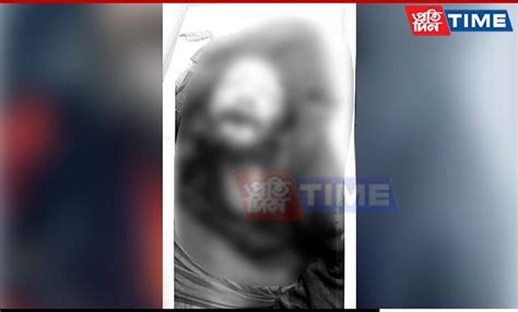 Unidentified Man Found Dead At Nilachal Hills In Guwahati Police Suspect Road Accident