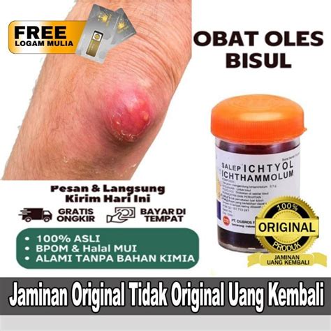 Jual Salep Ichtyol Cito Gr Salep Ampuh Atasi Bisul Salep Hitam