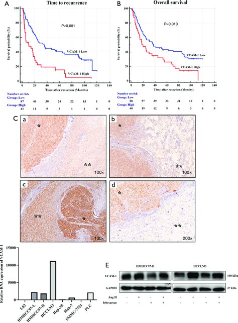 A High Level Of Vcam Rna Expression In Hcc Tissues Was Associated