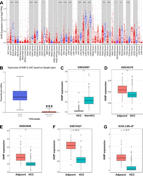 HHIP Expression Level In HCC A The MRNA Expression Level Of HHIP In