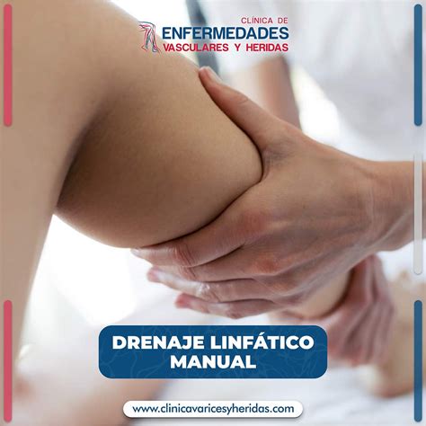 Tratamientos Para Telangiectasias Cl Nica De Enfermedades Vasculares