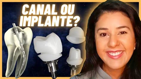 Tratamento De Canal Ou Implante Descubra Qual Deles Seu Dente Precisa