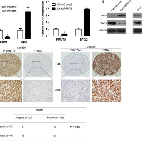 PRMT5 Knockdown Inhibits In Vitro And In Vivo HCC Cell Proliferation