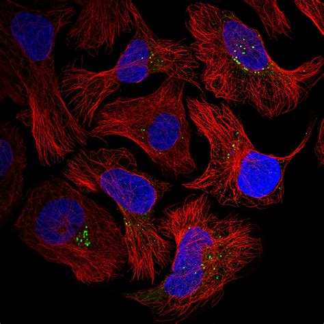 Subcellular Col A The Human Protein Atlas