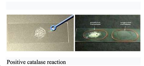Positive catalase reaction | Download Scientific Diagram