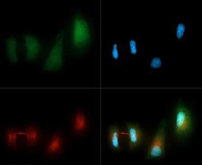 Anti-LC3B antibody (ab48394) | Abcam