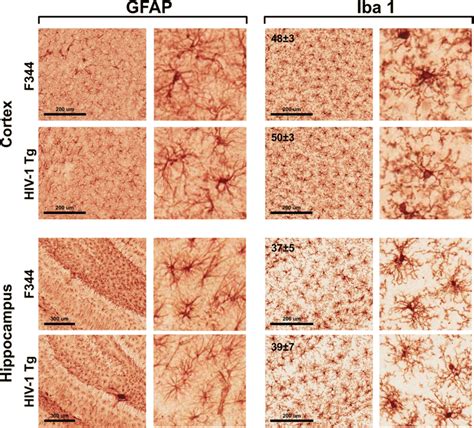 Immunoreactivity For Gfap And Iba Representative Images Of Gfap