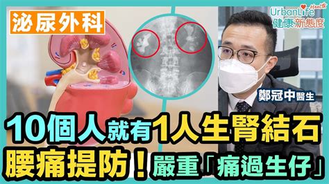 【腎結石症狀】10個人就有1人生腎結石 腰痛要提防！嚴重會「痛過生仔」 Youtube