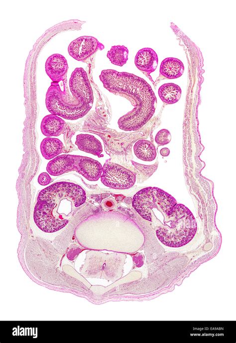 Human Fetus Abdomen Stained Section Showing General Structures Stock