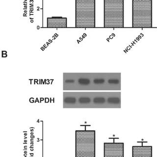 TRIM37 Is Highly Expressed In Human NSCLC Cell Lines A The MRNA