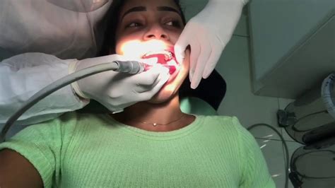 Painful Dental Drilling And Filling On Girl YouTube