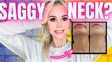 How To Tighten A Saggy Neck Treatments For Loose Neck Skin Youtube