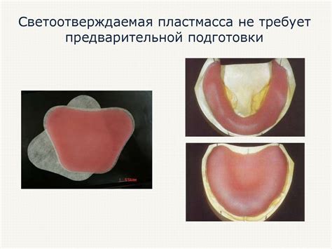 Изготовление индивидуальных ложек и окклюзионных валиков - презентация ...