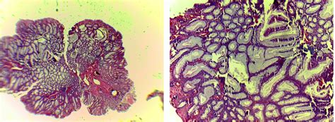 GASTROINTESTINAL AND LIVER HISTOLOGY PATHOLOGY ATLAS: COLON ...