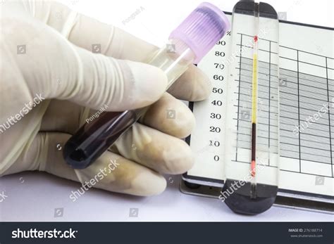 Hematocrit Test Hematology Laboratory Stock Photo Shutterstock