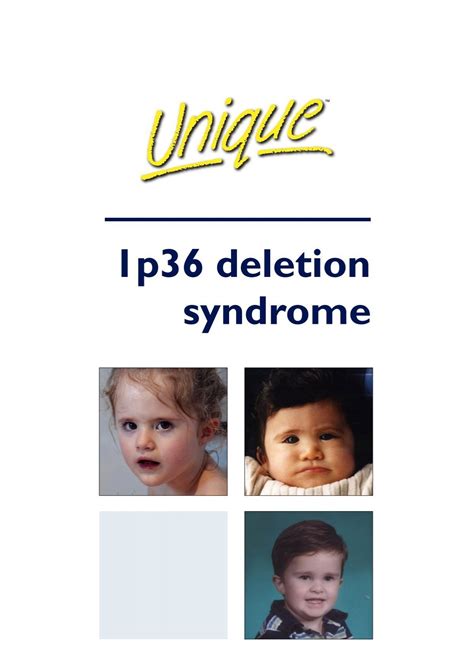 1p36 Deletion Syndrome Unique The Rare Chromosome Disorder