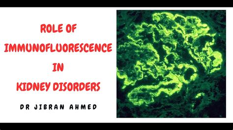 Role Of Immunofluorescence In Diagnosis Of Renal Biopsy Or Glomerular