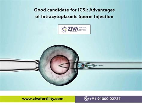 Intracytoplasmic Sperm Injection Icsi