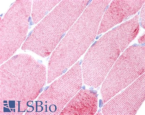 Ihc Plus™ Acta1 Skeletal Muscle Actin Monoclonal Antibody Lsbio