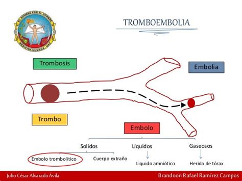 Trombo Vs Embolo Encrypted Tbn0 Gstatic Com Images Q Tbn