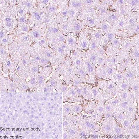 Anti p75 NGF Receptor 抗体 NORI146C BSA and Azide free ab271300