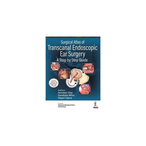 Surgical Atlas Of Transcanal Endoscopic Ear Surgery A Step By Step Guide