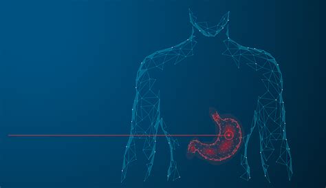 Tudo Sobre A Cirurgia BariÁtrica E MetabÓlica Leve Com Você