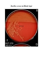 Lab Results Pdf Bacillus Cereus On Blood Agar Bacillus Cereus On